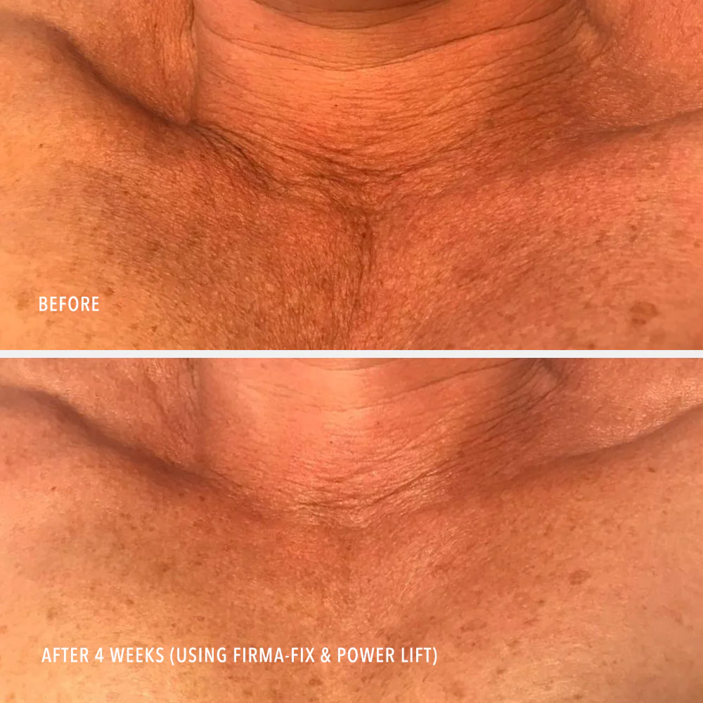 Ліфтинг-сироватка для шиї та зони декольте HydroPeptide Firm-A-Fix Nectar